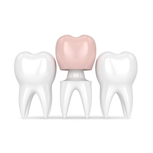 family dentistry alvin dental care alvin tx services crowns image 1