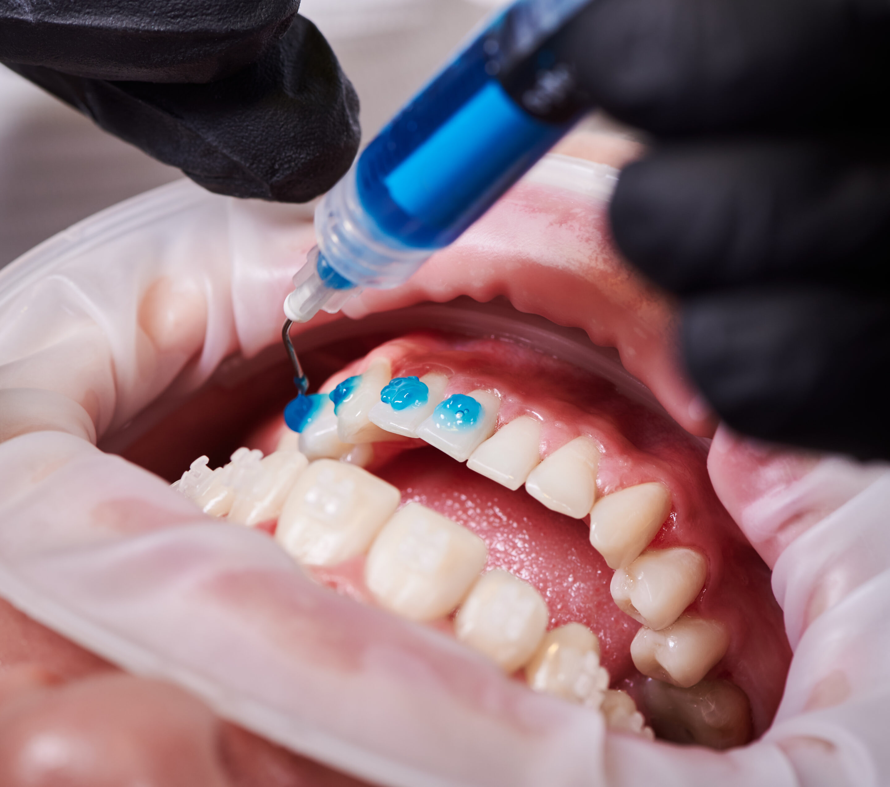 Alvin Dental Care