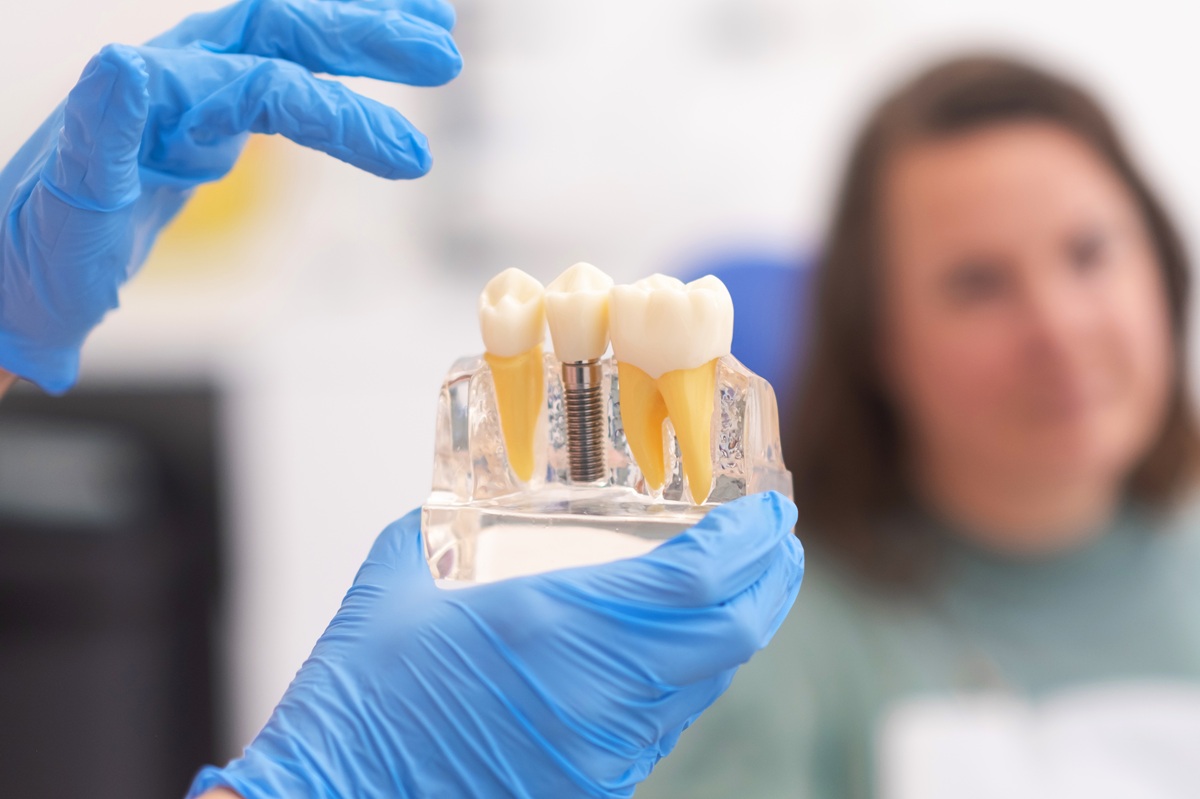 Dentist explaining dental implant facts to patient
