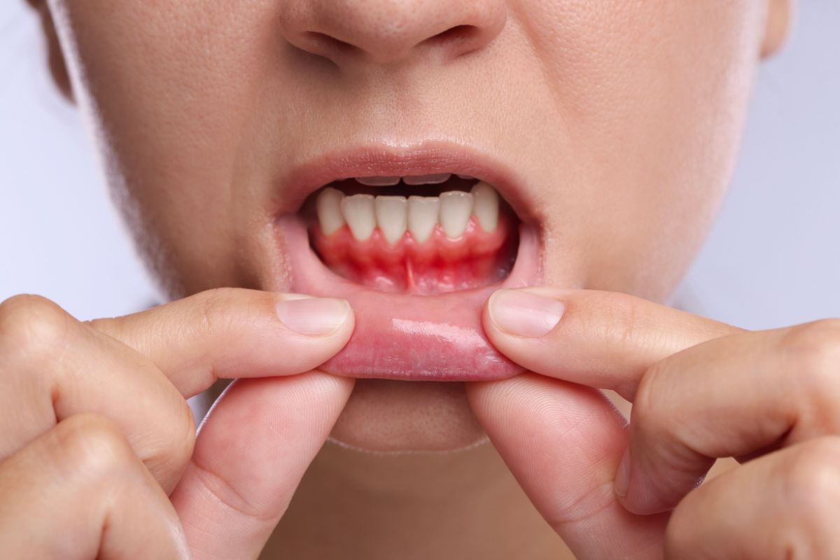 Why Gum Health Matters
