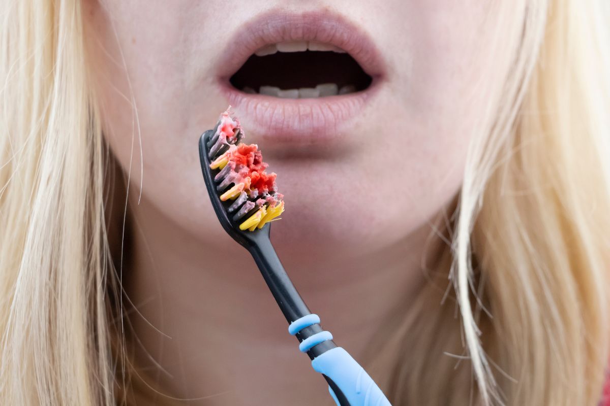Why Do My Gums Bleed When I Brush